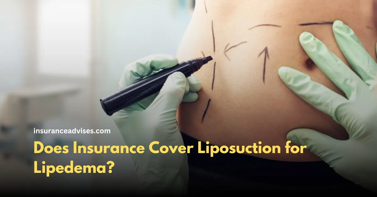 Does Insurance Cover Liposuction for Lipedema?